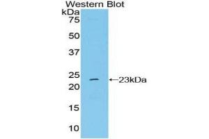 Western Blotting (WB) image for anti-NME/NM23 Nucleoside Diphosphate Kinase 6 (NME6) (AA 1-184) antibody (ABIN1860010) (NME6 抗体  (AA 1-184))