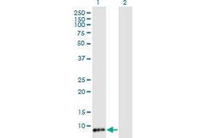 Western Blot analysis of TIMM8B expression in transfected 293T cell line by TIMM8B monoclonal antibody (M15), clone 8E5. (TIMM8B 抗体  (AA 1-83))