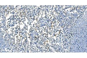IHC analysis of Carbonic Anhydrase I/CA1 using anti-Carbonic Anhydrase I/CA1 antibody (ABIN7602620). (CA1 抗体  (AA 9-261))