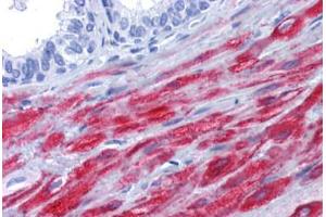 Human Prostate: Formalin-Fixed, Paraffin-Embedded (FFPE)