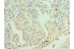 Immunohistochemistry (IHC) image for anti-Excision Repair Cross-Complementing Rodent Repair Deficiency, Complementation Group 2 (ERCC2) (AA 1-300) antibody (ABIN7171956)
