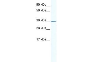 WB Suggested Anti-RNF130 Antibody Titration:  2. (RNF130 抗体  (N-Term))