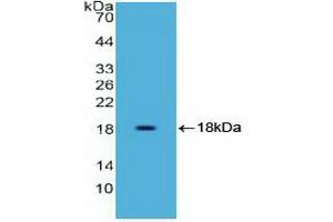 Detection of Recombinant HMGA1, Human using Polyclonal Antibody to High Mobility Group AT Hook Protein 1 (HMGA1) (HMGA1 抗体)