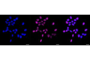 Immunocytochemical staining of HAP-1 cells with Phospho-Rad17 (S656) antibody (ABIN7800113), 1:1,000). (Recombinant RAD17 抗体  (pSer656))