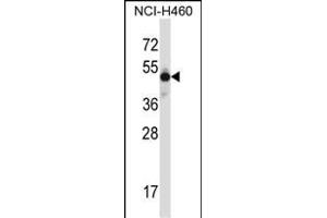 MKX Antibody (N-term) (ABIN657729 and ABIN2846714) western blot analysis in NCI- cell line lysates (35 μg/lane). (MKX 抗体  (N-Term))