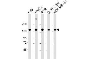 All lanes : Anti-C3 Antibody (C-term) at 1:2000 dilution Lane 1: Hela whole cell lysate Lane 2: HepG2 whole cell lysate Lane 3: K562 whole cell lysate Lane 4: CCRF-CEM whole cell lysate Lane 5: MDA-MB-453 whole cell lysate Lysates/proteins at 20 μg per lane. (C3 抗体  (AA 1353-1382))