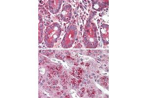 Immunohistochemistry (Formalin/PFA-fixed paraffin-embedded sections) of human small intestine (A) and human adrenal gland (B) tissue with GLP2R polyclonal antibody . (GLP2R 抗体  (C-Term))