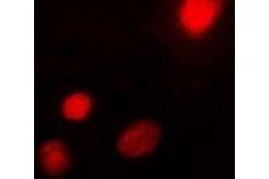 Immunofluorescent analysis of USF1 staining in Hela cells. (USF1 抗体)