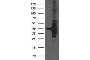 Western Blotting (WB) image for anti-HSPA Binding Protein, Cytoplasmic Cochaperone 1 (HSPBP1) antibody (ABIN1498759) (HSPBP1 抗体)