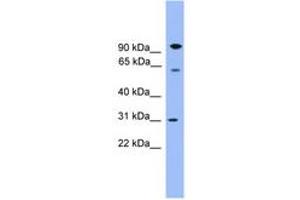 Image no. 1 for anti-Copine VI (CPNE6) (AA 401-450) antibody (ABIN6746586) (CPNE6 抗体  (AA 401-450))
