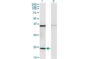 Western Blot analysis of RPL17 expression in transfected 293T cell line by RPL17 monoclonal antibody (M01), clone 3G11. (RPL17 抗体  (AA 1-184))