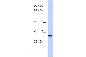 WB Suggested Anti-EFHD2 Antibody Titration: 0.