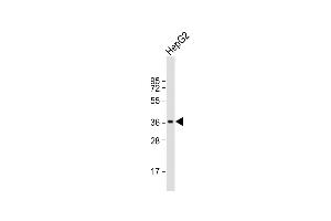 Anti-FOSBAntibody (Center) at 1:1000 dilution + HepG2 whole cell lysate Lysates/proteins at 20 μg per lane.