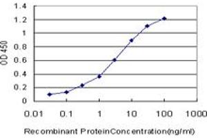 Detection limit for recombinant GST tagged OTX1 is approximately 0. (OTX1 抗体  (AA 10-116))
