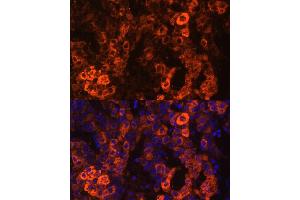 Immunofluorescence analysis of human liver cancer cells using BHMT antibody (ABIN3021749, ABIN3021750, ABIN3021751 and ABIN6215748) at dilution of 1:100. (BHMT 抗体  (AA 177-406))