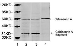 Lane 1: MarkerLane 2: Hela cell lysateLane 3: HEK293 cell lysateLane 4: NIH/3T3 cell lysateWestern blot analysis of cell lysates using 1 µg/mL Rabbit Anti-Calcineurin A Polyclonal Antibody (ABIN398733) The signal was developed with IRDyeTM 800 Conjugated Goat Anti-Rabbit IgG. (Calcineurin A 抗体  (AA 450-500))