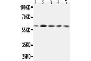Western Blotting (WB) image for anti-Growth Factor Receptor-Bound Protein 7 (GRB7) (AA 124-141), (Middle Region) antibody (ABIN5518677)