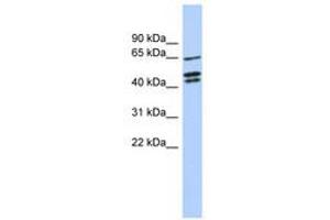 Image no. 1 for anti-Zinc Finger Protein 578 (ZNF578) (AA 107-156) antibody (ABIN6741085) (ZNF578 抗体  (AA 107-156))