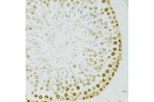 Immunohistochemistry of paraffin-embedded rat testis using ADAR antibody. (ADAR 抗体  (AA 150-250))