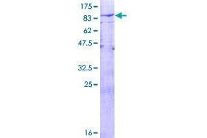 USP21 Protein (AA 1-565) (GST tag)