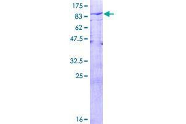 USP21 Protein (AA 1-565) (GST tag)