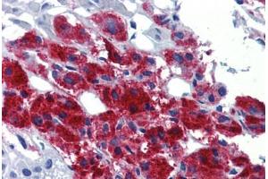 Human Adrenal (formalin-fixed, paraffin-embedded) stained with EGR2 antibody ABIN462263 followed by biotinylated goat anti-rabbit IgG secondary antibody ABIN481713, alkaline phosphatase-streptavidin and chromogen. (EGR2 抗体  (AA 397-446))