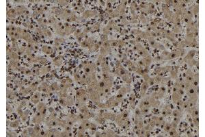 ABIN6272987 at 1/100 staining Human liver tissue by IHC-P. (ARL3 抗体  (C-Term))