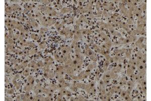 ABIN6272987 at 1/100 staining Human liver tissue by IHC-P. (ARL3 抗体  (C-Term))