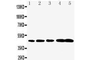 Anti-Caspase-1(P20) antibody,  Western blotting Lane 1: Rat Brain Tissue Lysate Lane 2: Rat Spleen Tissue Lysate Lane 3: Mouse Brain Tissue Lysate Lane 4: Mouse Spleen Tissue Lysate Lane 5: Mouse Testis Tissue Lysate