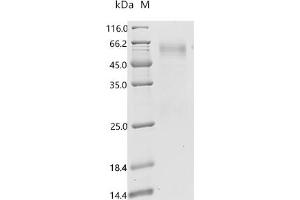 (Tris-Glycine gel) Discontinuous SDS-PAGE (reduced) with 5 % enrichment gel and 15 % separation gel.