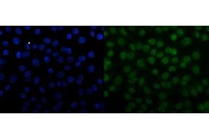 IF analysis of SNRPN using anti-SNRPN antibody (ABIN3043934).