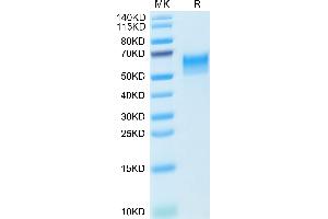 SDS-PAGE (SDS) image for CD4 (CD4) (AA 27-394) protein (His tag) (ABIN7274187)