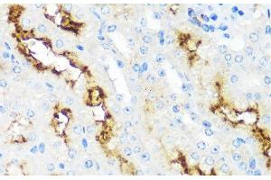 Immunohistochemistry of paraffin-embedded Mouse kidney using MME Polyclonal Antibody at dilution of 1:100 (40x lens). (MME 抗体)