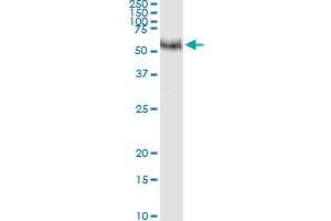 Immunoprecipitation of MMP8 transfected lysate using anti-MMP8 MaxPab rabbit polyclonal antibody and Protein A Magnetic Bead , and immunoblotted with MMP8 purified MaxPab mouse polyclonal antibody (B01P) . (MMP8 抗体  (AA 1-467))