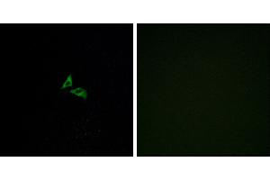 Peptide - +Western blot analysis of extracts from Jurkat cells, using EDG7 antibody. (LPAR3 抗体  (C-Term))