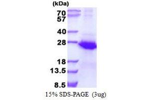 Image no. 1 for ECSIT (ECSIT) (AA 19-217) protein (His tag) (ABIN1098409)