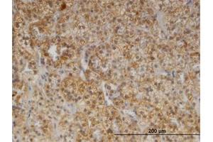 Image no. 1 for anti-Cerebellar Degeneration-Related Protein 2, 62kDa (CDR2) (AA 296-405) antibody (ABIN599360) (CDR2 抗体  (AA 296-405))