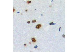 Immunohistochemical analysis of ZNF668 staining in human brain formalin fixed paraffin embedded tissue section. (ZNF668 抗体)