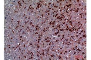 Immunohistochemistry (IHC) image for anti-Transient Receptor Potential Cation Channel, Subfamily C, Member 3 (TRPC3) (Internal Region) antibody (ABIN6283972)