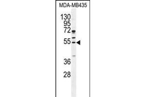 CCNB1 Antibody (Center) (ABIN655048 and ABIN2844676) western blot analysis in MDA-M cell line lysates (35 μg/lane). (Cyclin B1 抗体  (AA 241-268))
