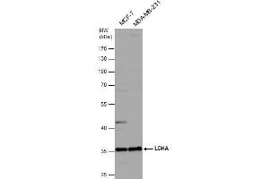 WB Image Various whole cell extracts (30 μg) were separated by 10% SDS-PAGE, and the membrane was blotted with LDHA antibody , diluted at 1:1000. (Lactate Dehydrogenase A 抗体)