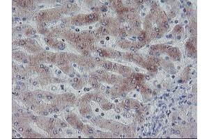Immunohistochemical staining of paraffin-embedded Human liver tissue using anti-C20orf3 mouse monoclonal antibody. (APMAP 抗体)