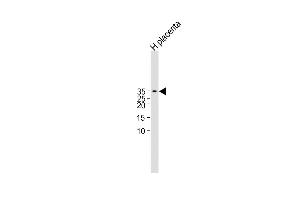 All lanes : Anti-CGB/HCG-Beta Antibody (C-term)at 1:1000 dilution Lane 1:Human placenta lysate Lysates/proteins at 20 μg per lane. (CGB 抗体  (C-Term))