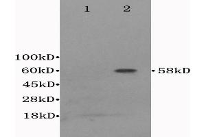 L1 Mouse cerebrum lysates, L2 mouse liver lysates probed with Anti- CD122/IL-2RB Polyclonal Antibody, Unconjugated (ABIN675923) at 1:300 in 4 °C. (IL2 Receptor beta 抗体  (AA 501-551))