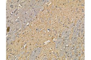 ABIN6264733 and ABIN6279767 at 1/100 staining rat brain tissue by IHC-P. (ARHGAP20 抗体  (Internal Region))