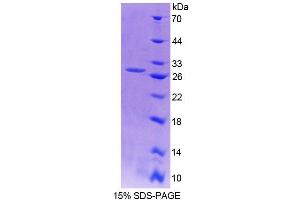 SDS-PAGE analysis of Mouse AFAP1 Protein. (AFAP 蛋白)