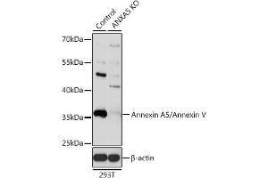 Western blot analysis of extracts from normal (control) and Annexin /Annexin V knockout (KO) 293T cells, using Annexin /Annexin V antibody (ABIN3022450, ABIN3022451, ABIN3022452 and ABIN1512578) at 1:1000 dilution.
