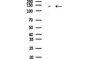 anti-Mastermind-Like 2 (MAML2) (C-Term) antibody