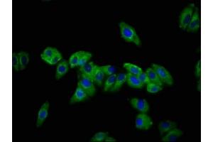 Immunofluorescence staining of HepG2 cells with ABIN7149771 at 1:133, counter-stained with DAPI. (Desmocollin 3 抗体  (AA 712-896))