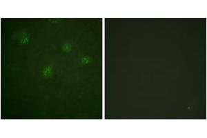 Immunofluorescence analysis of A549 cells, using Estrogen Receptor-alpha (Ab-537) Antibody. (Estrogen Receptor alpha 抗体  (AA 501-550))